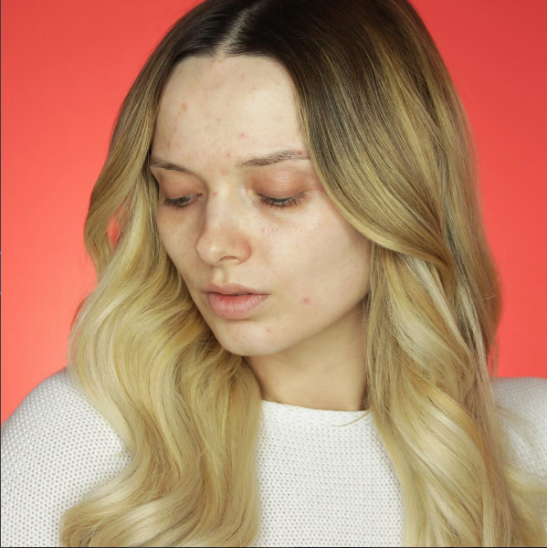 Instagram: @mypaleskinblog